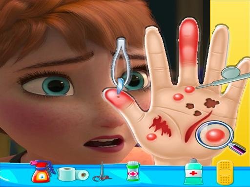 Play: Anna frozen Hand Doctor Fun Games for Girls Onlin Img